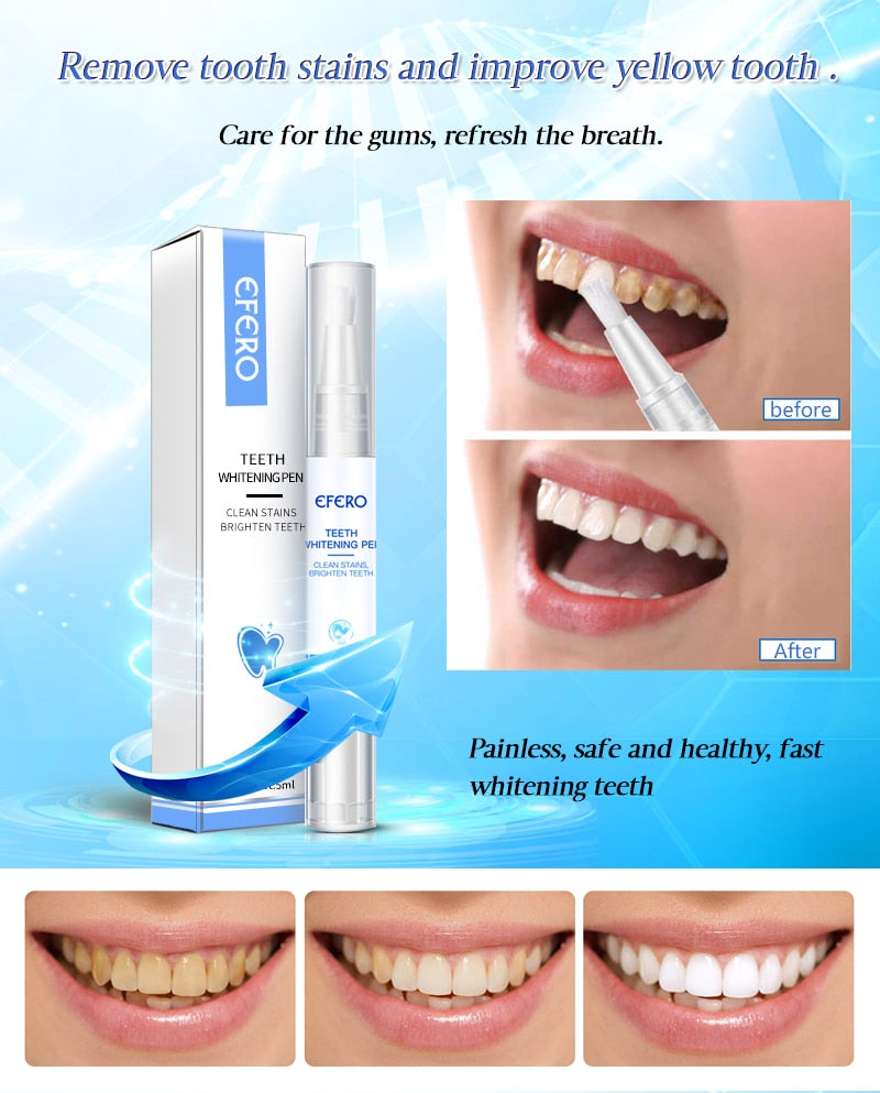 Teeth Whitening Pen | White Teeth Whitening Pen Tooth Gel Whitener Bleach Remove Plaque Stains Dental Tools Oral Hygiene Teeth Cleaning Serum